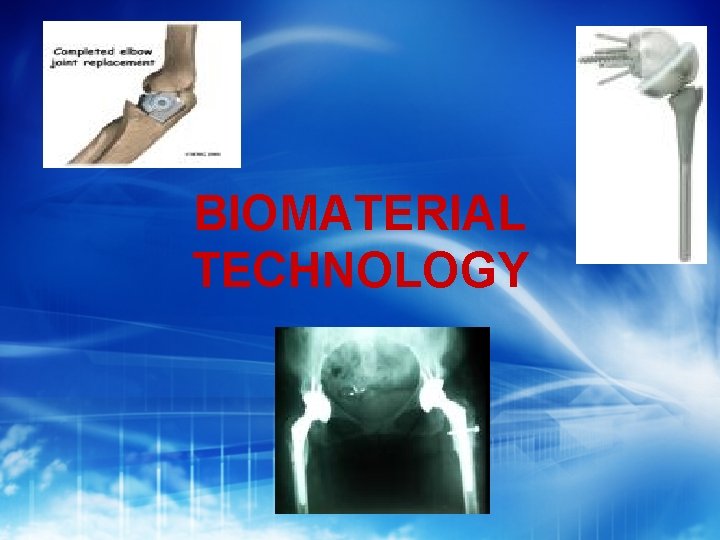 BIOMATERIAL TECHNOLOGY 