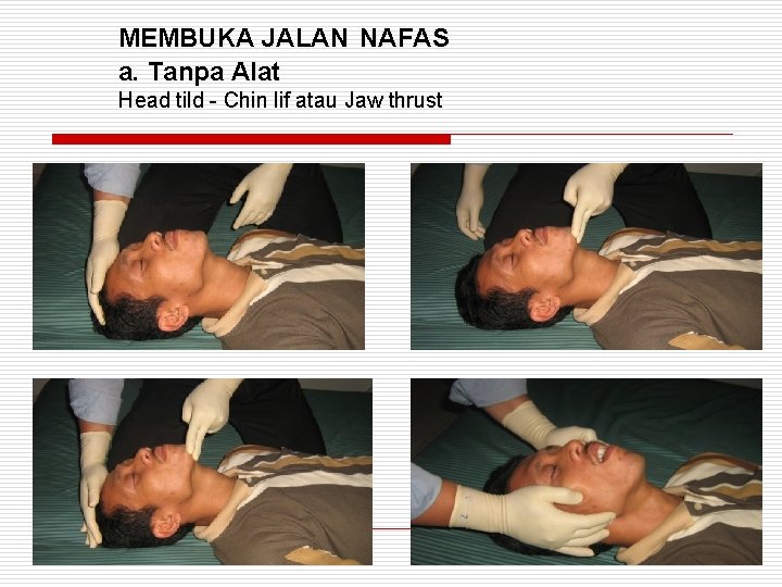 MEMBUKA JALAN NAFAS a. Tanpa Alat Head tild - Chin lif atau Jaw thrust