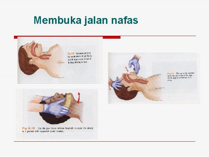 Membuka jalan nafas 