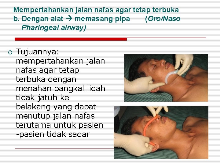 Mempertahankan jalan nafas agar tetap terbuka b. Dengan alat memasang pipa (Oro/Naso Pharingeal airway)