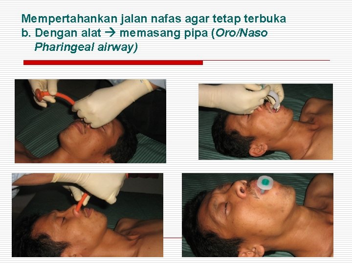 Mempertahankan jalan nafas agar tetap terbuka b. Dengan alat memasang pipa (Oro/Naso Pharingeal airway)