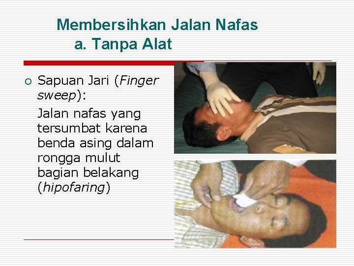 Membersihkan Jalan Nafas a. Tanpa Alat Sapuan Jari (Finger sweep): Jalan nafas yang tersumbat