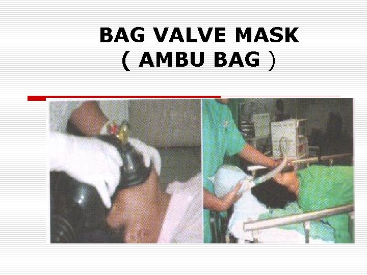 BAG VALVE MASK ( AMBU BAG ) 