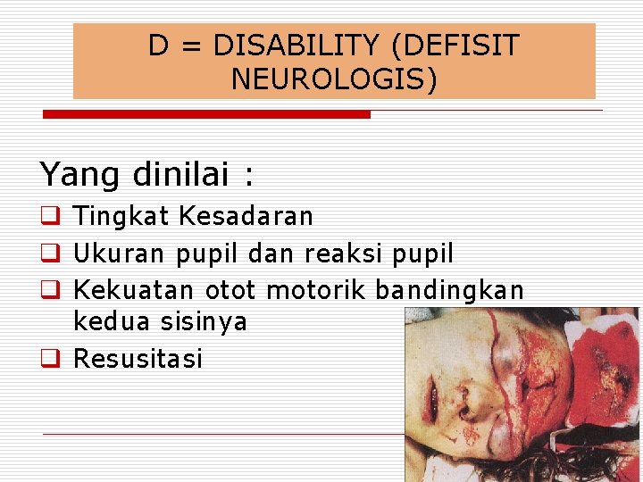 D = DISABILITY (DEFISIT NEUROLOGIS) Yang dinilai : q Tingkat Kesadaran q Ukuran pupil