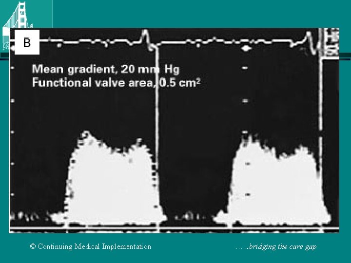© Continuing Medical Implementation …. . . bridging the care gap 