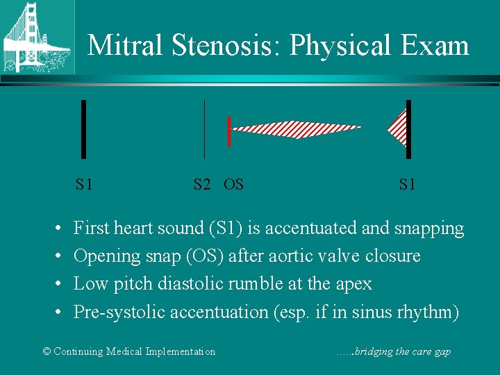 Mitral Stenosis: Physical Exam S 1 • • S 2 OS S 1 First