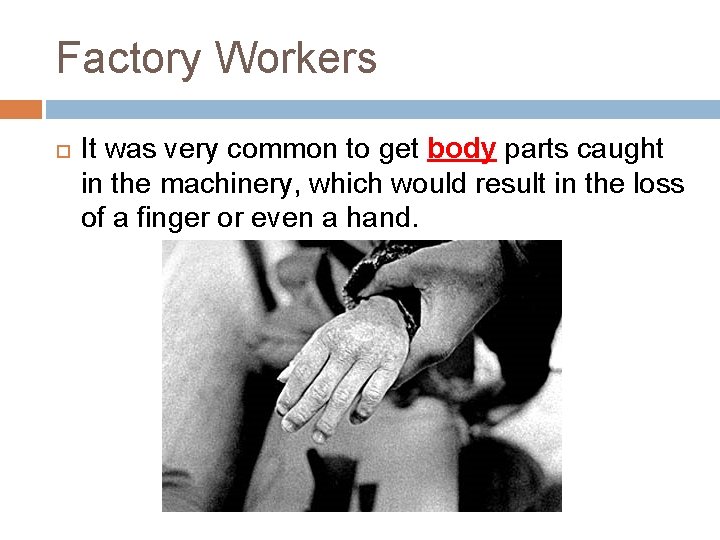 Factory Workers It was very common to get body parts caught in the machinery,