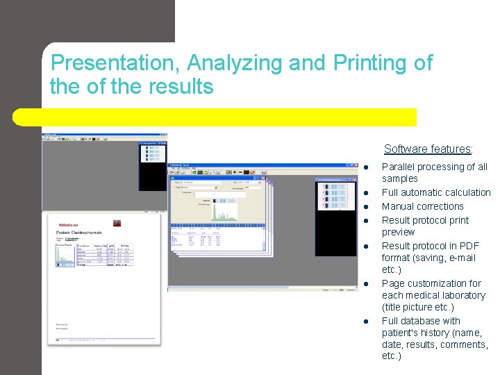 Presentation, Analyzing and Printing of the results Software features: l l l l Parallel Presentation, Analyzing and Printing of the results Software features: l l l l Parallel