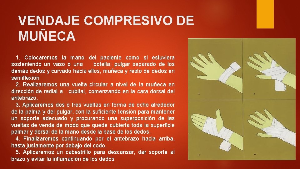 VENDAJE COMPRESIVO DE MUÑECA 1. Colocaremos la mano del paciente como si estuviera sosteniendo VENDAJE COMPRESIVO DE MUÑECA 1. Colocaremos la mano del paciente como si estuviera sosteniendo