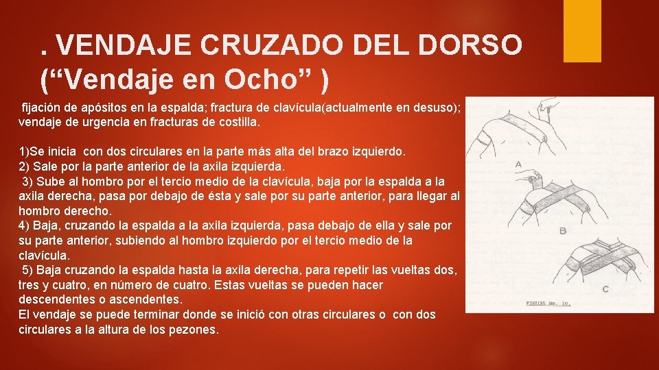 . VENDAJE CRUZADO DEL DORSO (“Vendaje en Ocho” ) fijación de apósitos en la . VENDAJE CRUZADO DEL DORSO (“Vendaje en Ocho” ) fijación de apósitos en la