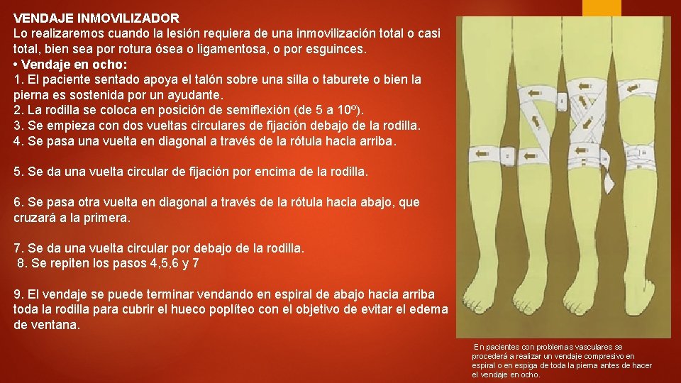 VENDAJE INMOVILIZADOR Lo realizaremos cuando la lesión requiera de una inmovilización total o casi VENDAJE INMOVILIZADOR Lo realizaremos cuando la lesión requiera de una inmovilización total o casi