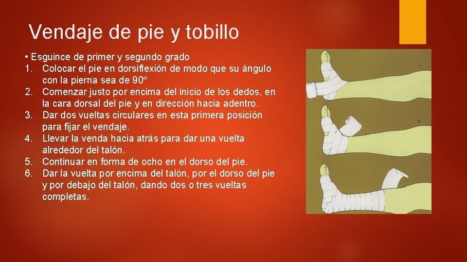 Vendaje de pie y tobillo • Esguince de primer y segundo grado 1. Colocar Vendaje de pie y tobillo • Esguince de primer y segundo grado 1. Colocar