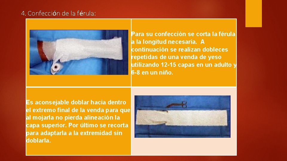 4. Confección de la férula: Para su confección se corta la férula a la 4. Confección de la férula: Para su confección se corta la férula a la