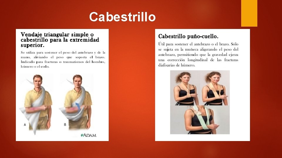 Cabestrillo Cabestrillo