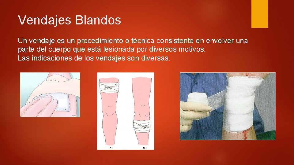 Vendajes Blandos Un vendaje es un procedimiento o técnica consistente en envolver una parte Vendajes Blandos Un vendaje es un procedimiento o técnica consistente en envolver una parte