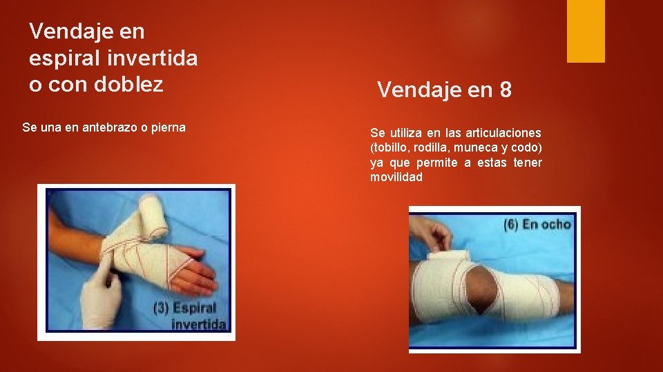 Vendaje en espiral invertida o con doblez Se una en antebrazo o pierna Vendaje Vendaje en espiral invertida o con doblez Se una en antebrazo o pierna Vendaje