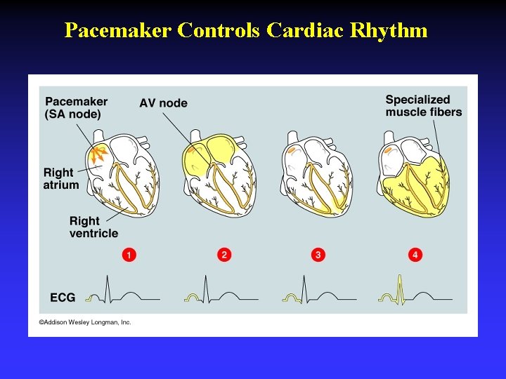 Pacemaker Controls Cardiac Rhythm 
