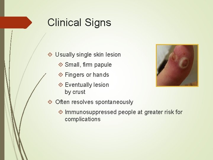 Clinical Signs Usually single skin lesion Small, firm papule Fingers or hands Eventually lesion