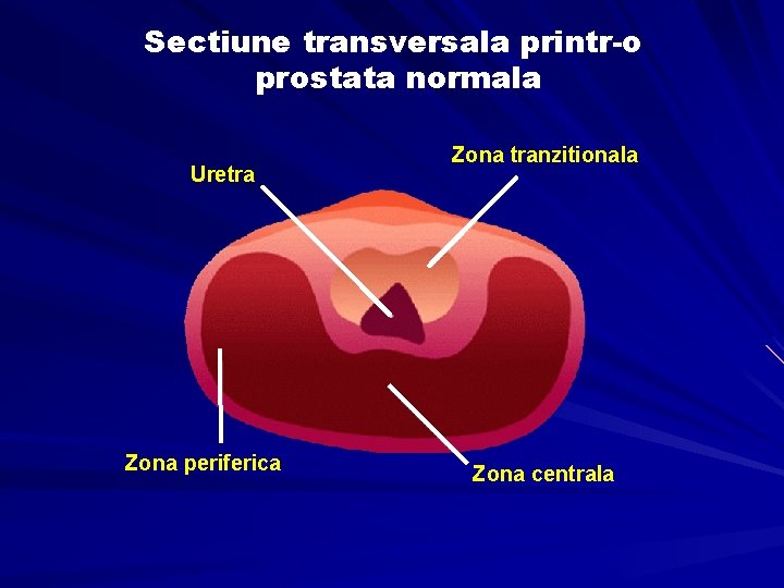 Dimensiunea standard a prostatei si posibila boala