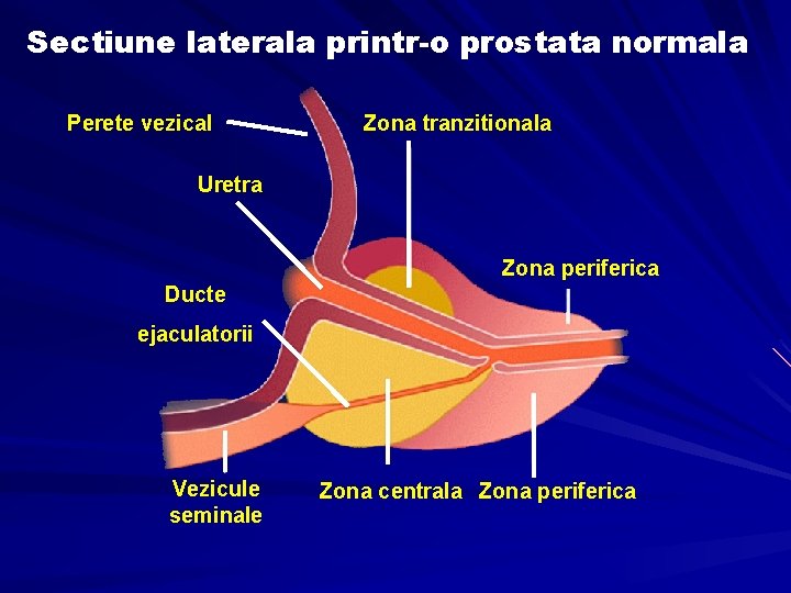 Simptomele şi diagnosticul adenomului de prostată