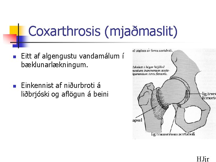 Coxarthrosis (mjaðmaslit) n n Eitt af algengustu vandamálum í bæklunarlækningum. Einkennist af niðurbroti á