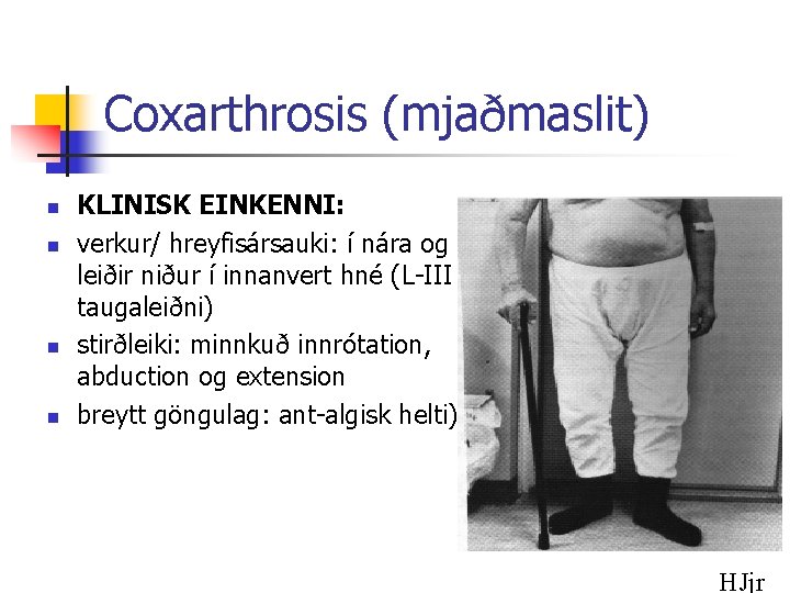 Coxarthrosis (mjaðmaslit) n n KLINISK EINKENNI: verkur/ hreyfisársauki: í nára og leiðir niður í