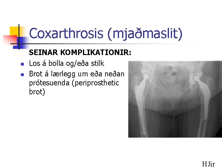 Coxarthrosis (mjaðmaslit) n n SEINAR KOMPLIKATIONIR: Los á bolla og/eða stilk Brot á lærlegg