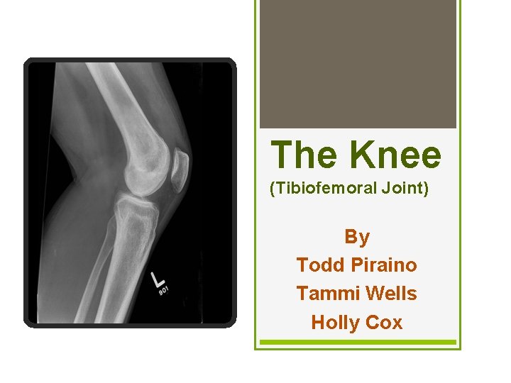 The Knee (Tibiofemoral Joint) By Todd Piraino Tammi Wells Holly Cox 