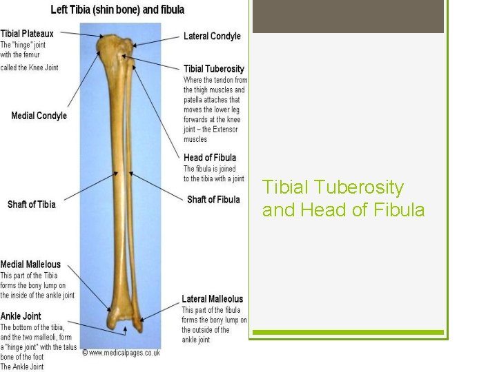 Tibial Tuberosity and Head of Fibula 