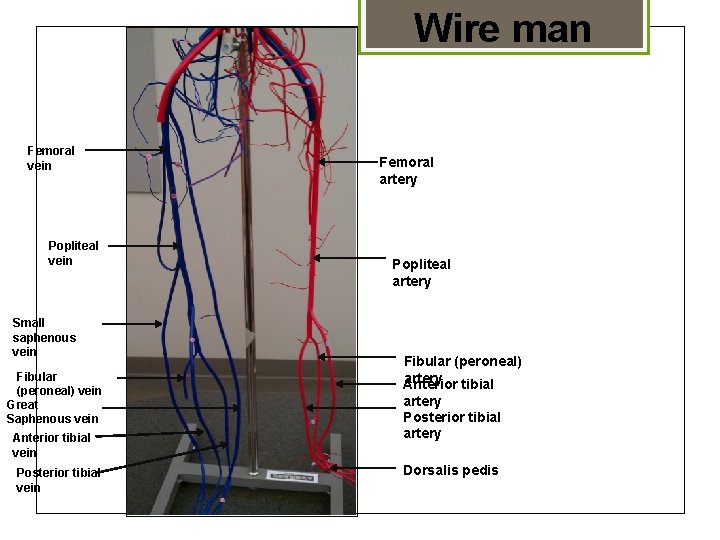 Wire man Femoral vein Popliteal vein Small saphenous vein Fibular (peroneal) vein Great Saphenous