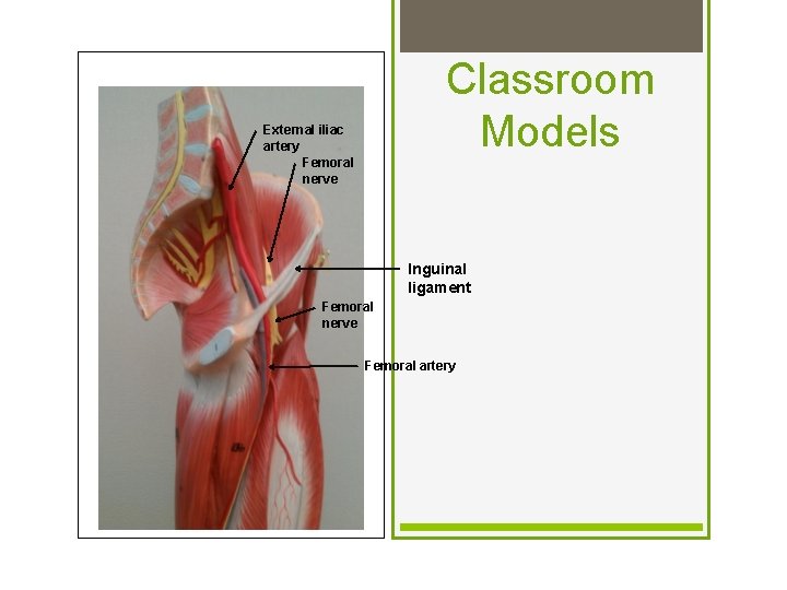 Classroom Models External iliac artery Femoral nerve Inguinal ligament Femoral nerve Femoral artery 