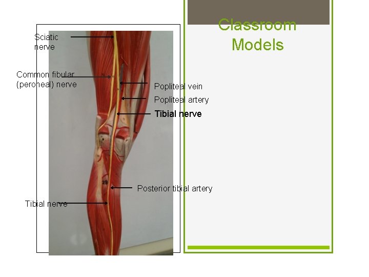 Classroom Models Sciatic nerve Common fibular (peroneal) nerve Popliteal vein Popliteal artery Tibial nerve