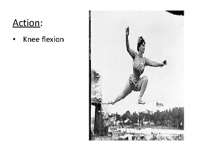 Action: • Knee flexion 