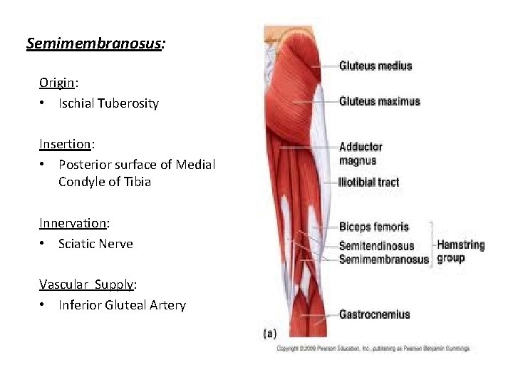 Semimembranosus: Origin: • Ischial Tuberosity Insertion: • Posterior surface of Medial Condyle of Tibia