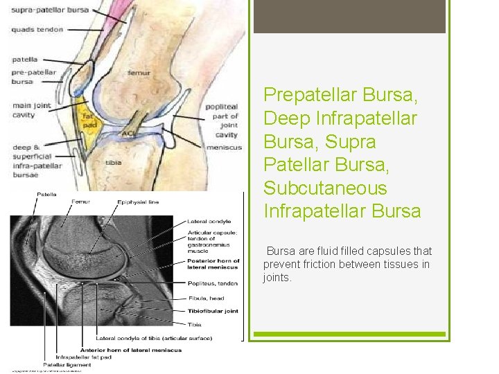Prepatellar Bursa, Deep Infrapatellar Bursa, Supra Patellar Bursa, Subcutaneous Infrapatellar Bursa are fluid filled