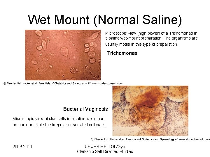 Wet Mount (Normal Saline) Microscopic view (high power) of a Trichomonad in a saline Wet Mount (Normal Saline) Microscopic view (high power) of a Trichomonad in a saline