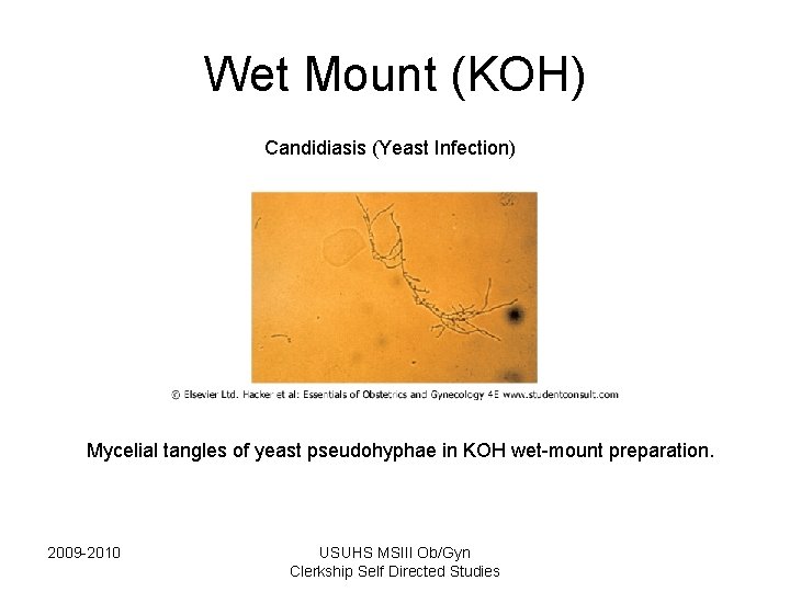 Wet Mount (KOH) Candidiasis (Yeast Infection) Mycelial tangles of yeast pseudohyphae in KOH wet-mount Wet Mount (KOH) Candidiasis (Yeast Infection) Mycelial tangles of yeast pseudohyphae in KOH wet-mount