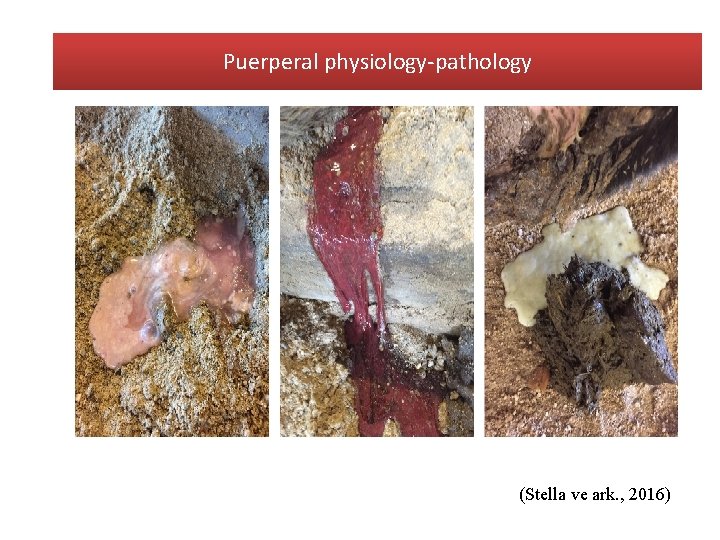 Puerperal physiology-pathology (Stella ve ark. , 2016) 