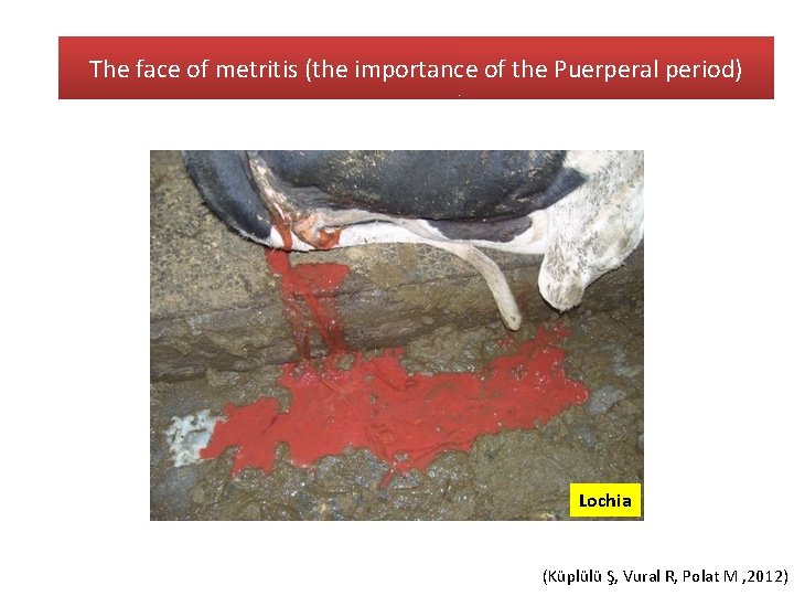 The face of metritis (the importance of the Puerperal period) Lochia (Küplülü Ş, Vural
