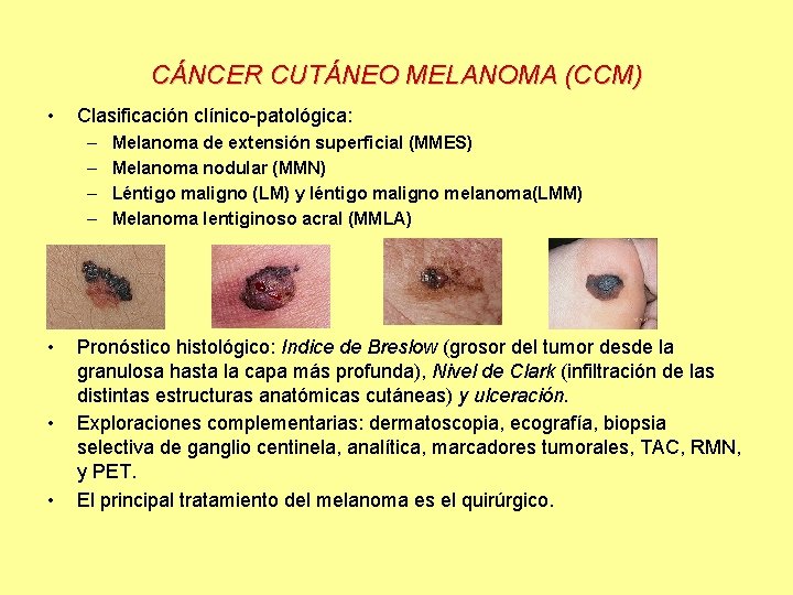 CÁNCER CUTÁNEO MELANOMA (CCM) • Clasificación clínico-patológica: – – • • • Melanoma de