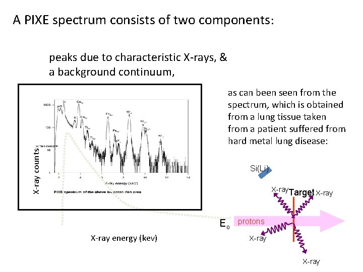 A PIXE spectrum consists of two components: peaks due to characteristic X-rays, & a