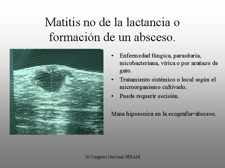 Matitis no de la lactancia o formación de un absceso. • Enfermedad fúngica, parasitaria,