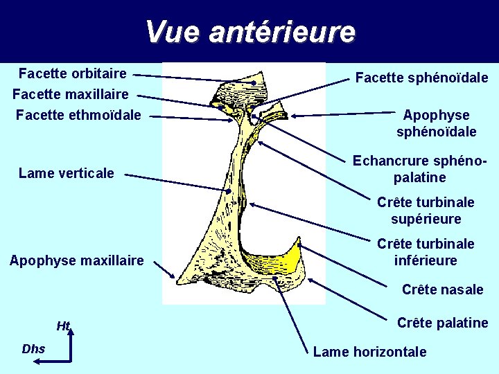 Vue antérieure Facette orbitaire Facette maxillaire Facette ethmoïdale Lame verticale Facette sphénoïdale Apophyse sphénoïdale Vue antérieure Facette orbitaire Facette maxillaire Facette ethmoïdale Lame verticale Facette sphénoïdale Apophyse sphénoïdale