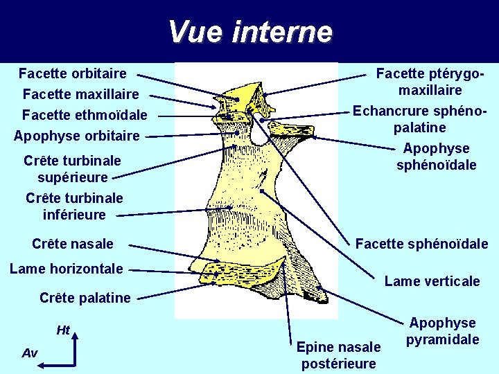Vue interne Facette orbitaire Facette maxillaire Facette ethmoïdale Apophyse orbitaire Crête turbinale supérieure Crête Vue interne Facette orbitaire Facette maxillaire Facette ethmoïdale Apophyse orbitaire Crête turbinale supérieure Crête