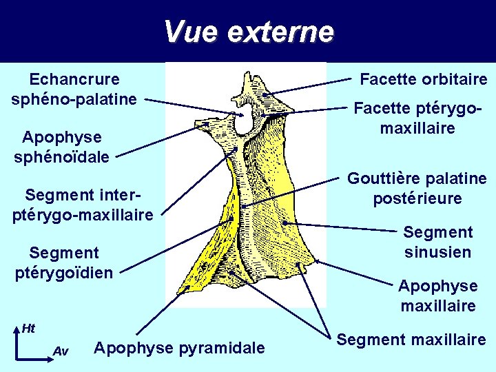 Vue externe Echancrure sphéno-palatine Apophyse sphénoïdale Segment interptérygo-maxillaire Segment ptérygoïdien Ht Av Apophyse pyramidale Vue externe Echancrure sphéno-palatine Apophyse sphénoïdale Segment interptérygo-maxillaire Segment ptérygoïdien Ht Av Apophyse pyramidale