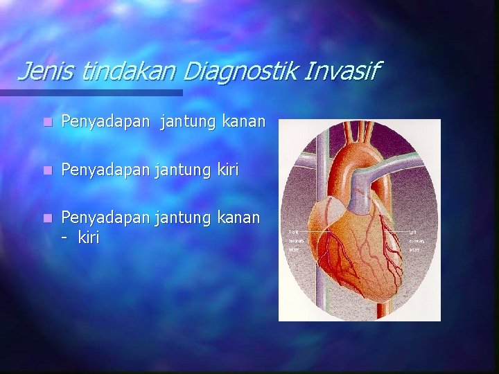 Jenis tindakan Diagnostik Invasif n Penyadapan jantung kanan n Penyadapan jantung kiri n Penyadapan