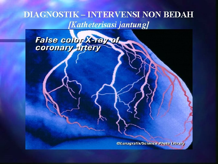 DIAGNOSTIK – INTERVENSI NON BEDAH [Katheterisasi jantung] 