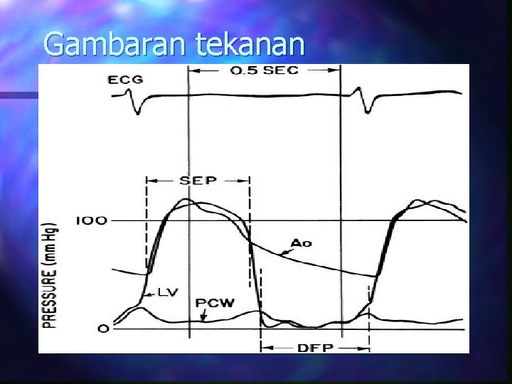 Gambaran tekanan 