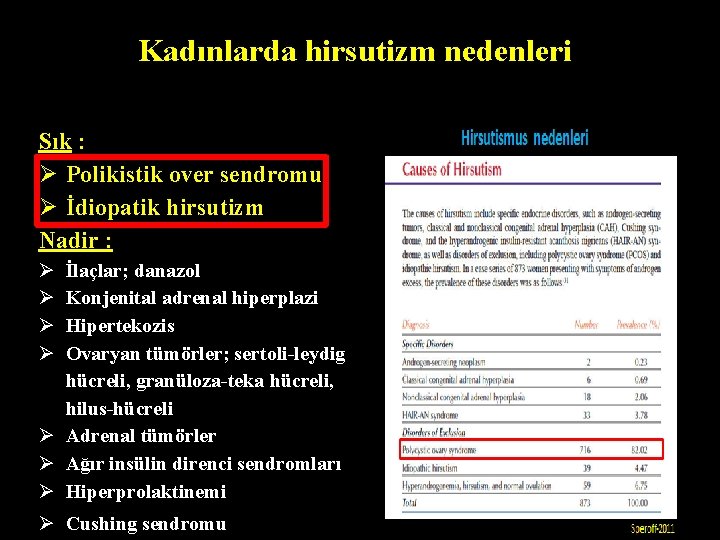 Kadınlarda hirsutizm nedenleri Sık : Ø Polikistik over sendromu Ø İdiopatik hirsutizm Nadir : Kadınlarda hirsutizm nedenleri Sık : Ø Polikistik over sendromu Ø İdiopatik hirsutizm Nadir :
