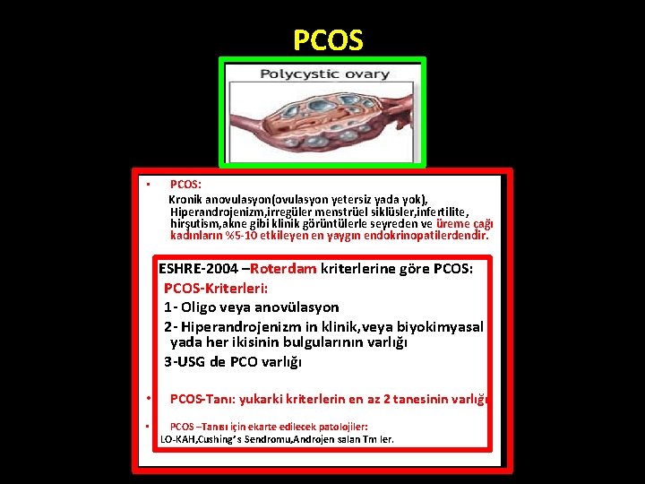PCOS • PCOS: Kronik anovulasyon(ovulasyon yetersiz yada yok), Hiperandrojenizm, irregüler menstrüel siklüsler, infertilite, hirşutism, PCOS • PCOS: Kronik anovulasyon(ovulasyon yetersiz yada yok), Hiperandrojenizm, irregüler menstrüel siklüsler, infertilite, hirşutism,